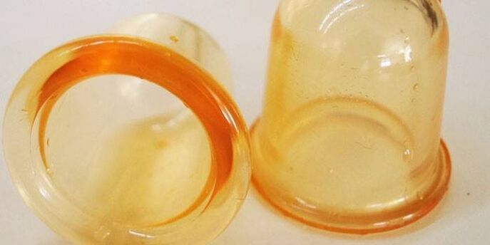 чашки для лікування простатиту